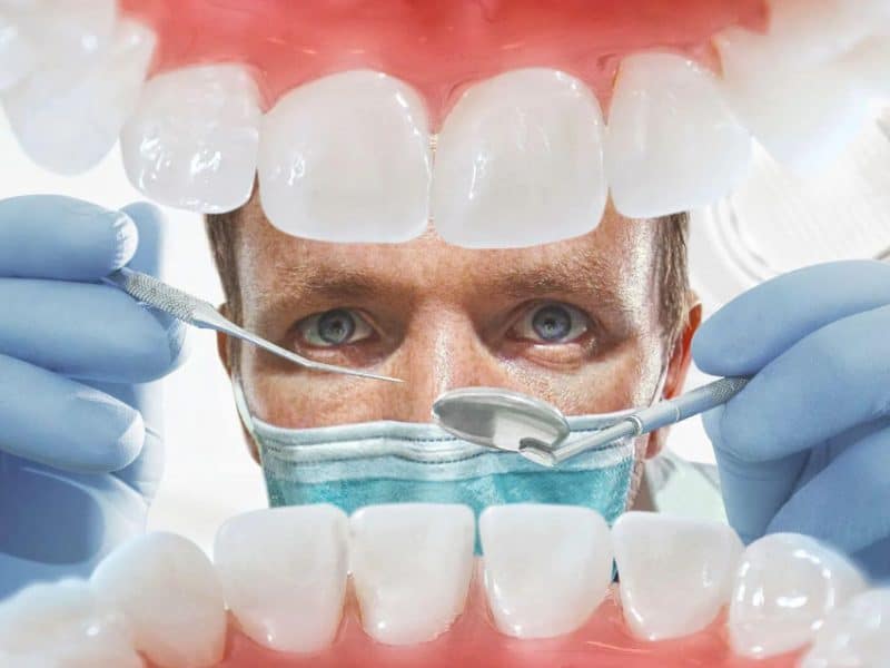 Diş Kaplama İşlemi Nedir?